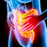 Consigli, rimedi e diete per chi soffre di colite ulcerosa