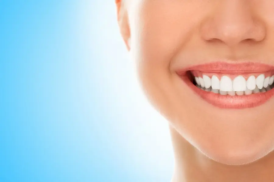 Come sbiancare naturalmente i denti